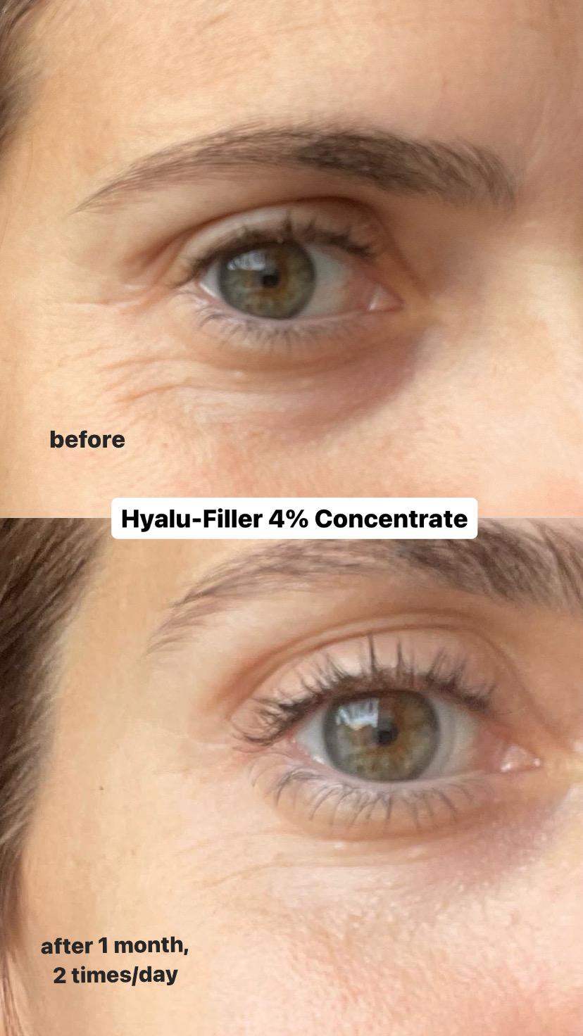 ADESSO. BEAUTY - HYALU-FILLER 4% CONCENTRATE